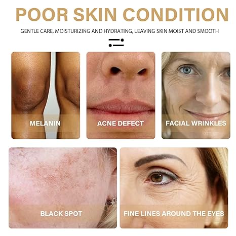 3PCS Turmeric Dark Spot Corrector Serum Oil,Turmeric Repair Face Serum, Natural Turmeric Skin Dark Spot Skin Care Moisturizing Repair Serum,Turmeric Serum for Face & Body(30Ml)